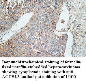 ACTBL3 Antibody