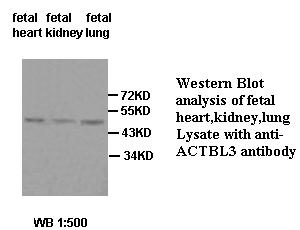 ACTBL3 Antibody