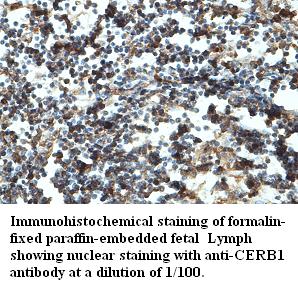 CERB1 Antibody