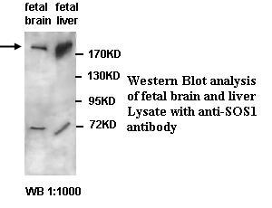 SOS1 Antibody