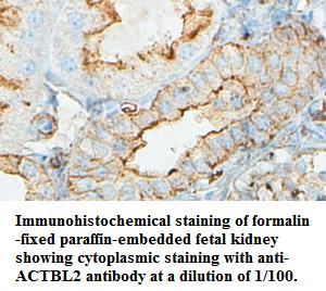 ACTBL2 Antibody