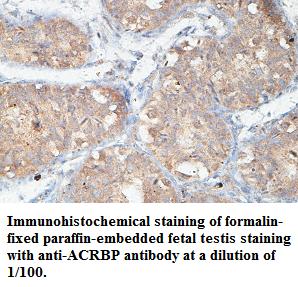 ACRBP Antibody