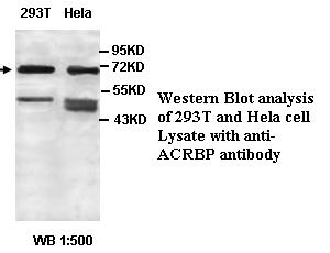 ACRBP Antibody