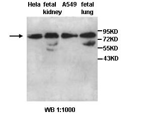 AARSD1 Antibody