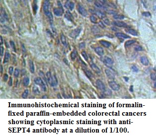 SEPT4 Antibody