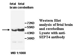 SEPT4 Antibody