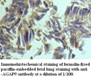 AGAP9 Antibody