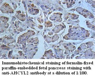 AHCYL2 Antibody