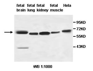 AHCYL2 Antibody