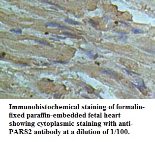 PARS2 Antibody