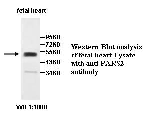 PARS2 Antibody