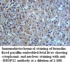 HRSP12 Antibody