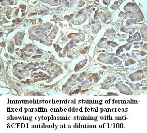 SCFD1 Antibody