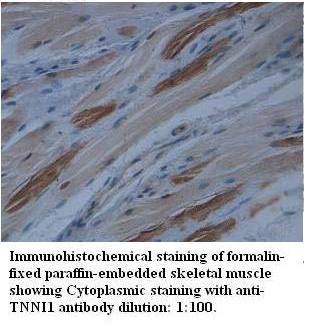 TNNI1 Antibody