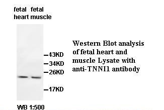 TNNI1 Antibody