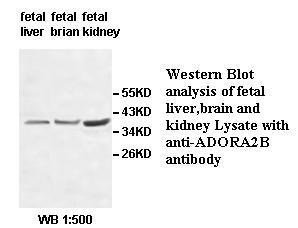 ADORA2B Antibody