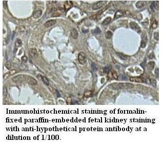 hypothetical protein Antibody