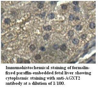 AGXT2 Antibody