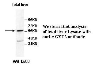 AGXT2 Antibody