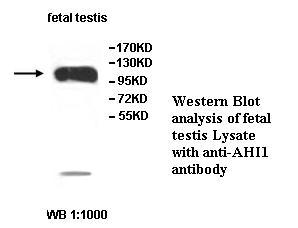 AHI1 Antibody