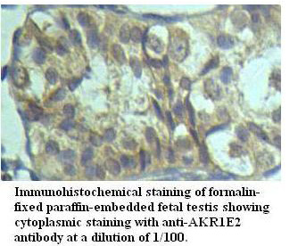 AKR1E2 Antibody