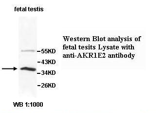 AKR1E2 Antibody