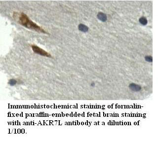 AKR7L Antibody