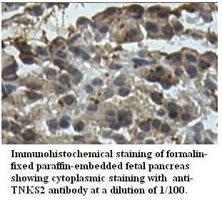 TNKS2 Antibody