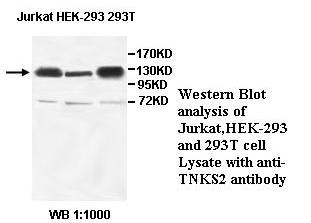 TNKS2 Antibody