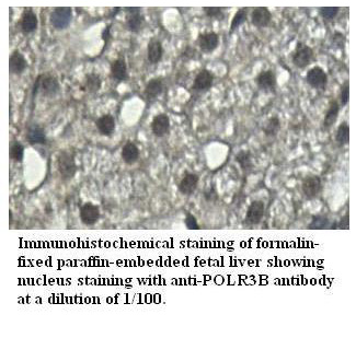 POLR3B Antibody