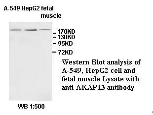 AKAP13 Antibody