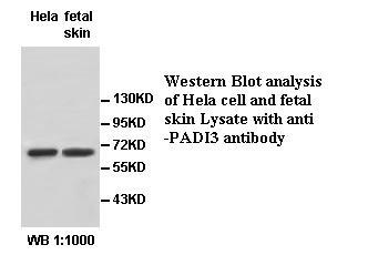 PADI3 Antibody