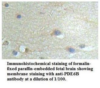 PDE6B Antibody