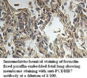 PCDHB7 Antibody