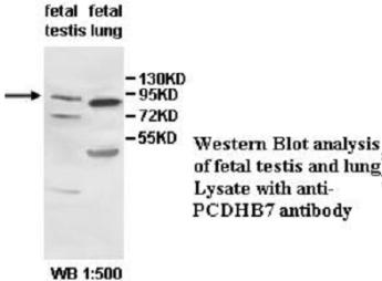 PCDHB7 Antibody