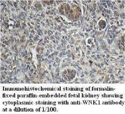 WNK1 Antibody