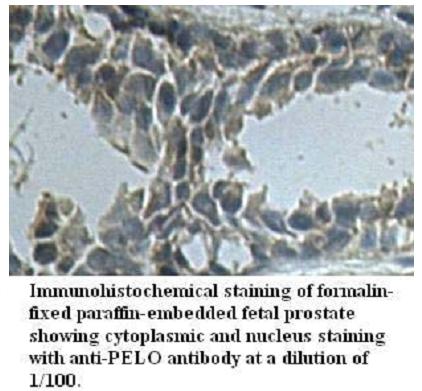 PELO Antibody