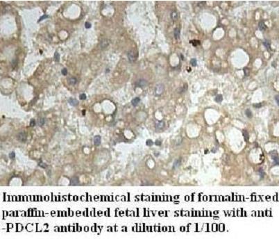 PDCL2 Antibody