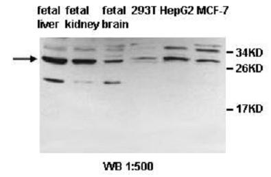 PDCL2 Antibody