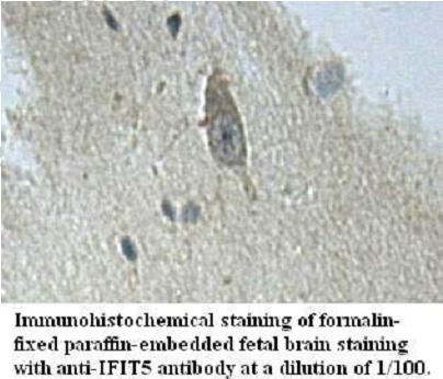 IFIT5 Antibody