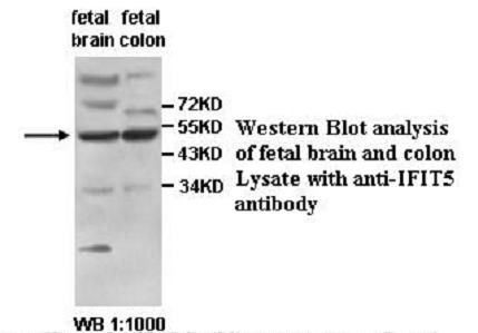 IFIT5 Antibody