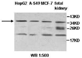 ZNF101 Antibody