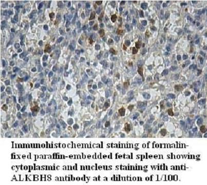 ALKBH8 Antibody