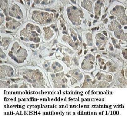 ALKBH4 Antibody