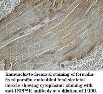 INPP5K Antibody