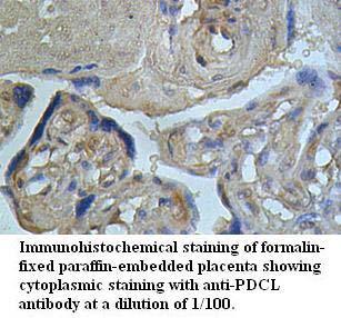 PDCL Antibody