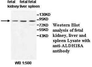 ALDH18A Antibody