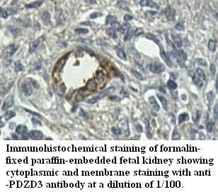 PDZD3 Antibody