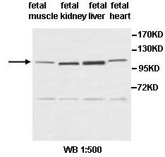 PDE3A Antibody