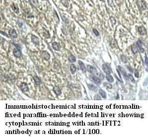 IFIT2 Antibody